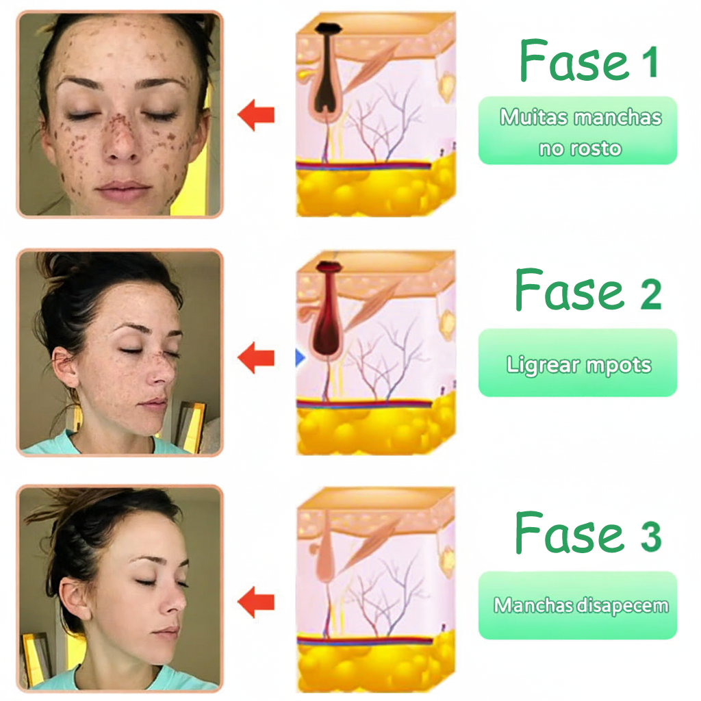 Gel Esfoliante Purificante: Limpeza Profunda e Pele Suave - Image 4